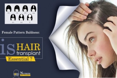 Female Pattern Baldness: is hair transplant essential?
