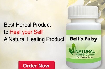 Herbal Treatment for Bell’s Palsy - Natural Herbs Clinic