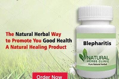 Herbal Treatment for Blepharitis - Natural Herbs Clinic