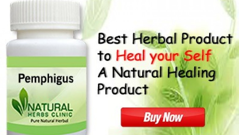 Pemphigus Natural Herbal Treatment, Key Facts, Symptoms, Causes - Natural Herbs Clinic