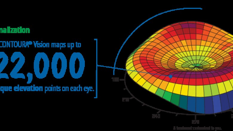 Contoura Vision Lasik Laser Specs Removal Surgery Gurgaon - AEDI