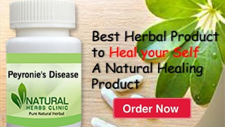 Herbal Treatment for Peyronie’s Disease - Natural Herbs Clinic