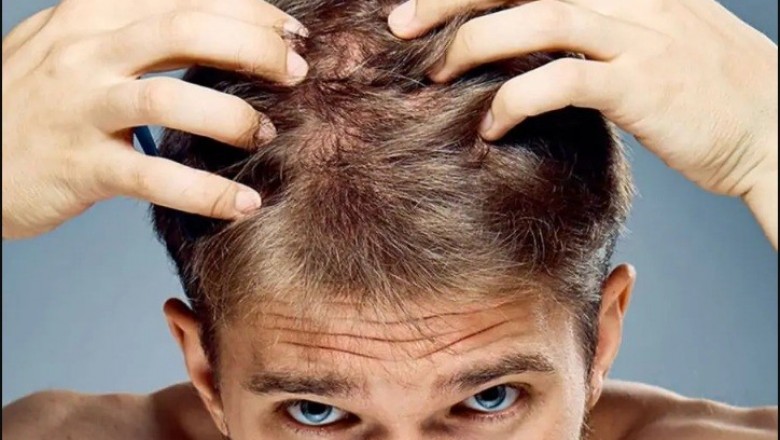 What Does Hair Lotion Do?