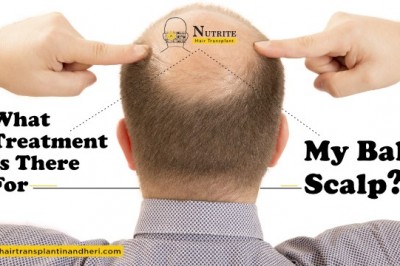 What Treatment Is There For My Bald Scalp?
