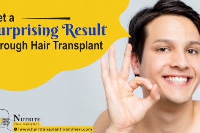 Get a Surprising Result through Hair Transplant