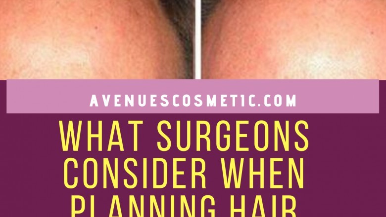 What Surgeons Consider When Planning Hair Surgery?