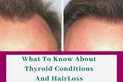 What To Know About Thyroid Conditions And HairLoss