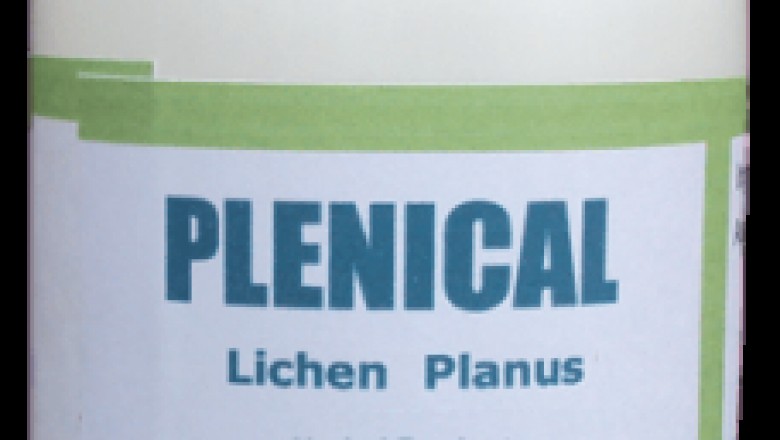 Herbal Treatment for Oral Lichen Planus