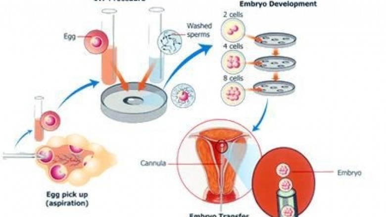 Best IVF Treatment in Hyderabad | IVF Cost | IVF Doctor in Banjara Hills