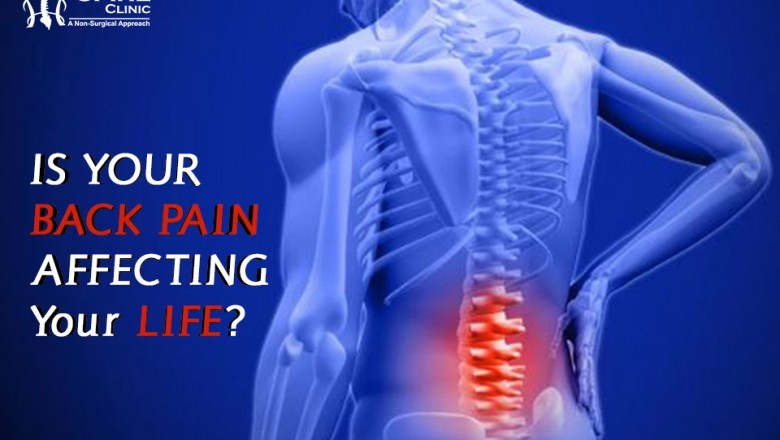 Spinal Stenosis Treatment in India