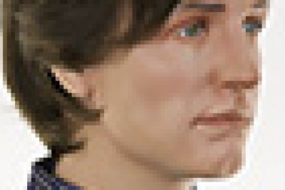 Hair loss solutions for Men