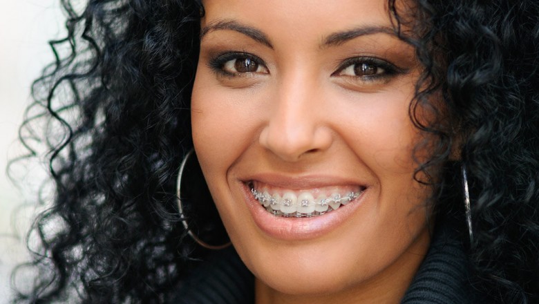 Dentist in Cypress | Cosmetic &amp; General Dentistry | Mirabella Smiles