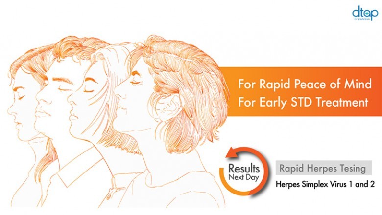 Herpes Testing - Womens-health.sg