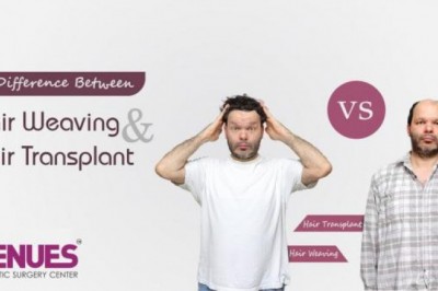 Difference Between Hair Weaving and Hair Transplant