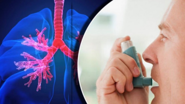 Best allergy hospital in jaipur| MediHub Clinic