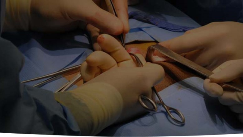 Laparoscopic Inguinal & Umbilical Hernia Repair & Surgery India