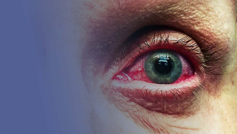 Glaucoma in Fort Myers and Naples - Diagnosis, Prevention & Treatment