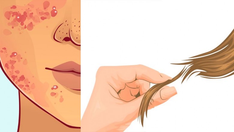 Zinc Deficiency: Symptoms, Risk Factors, and Treatment