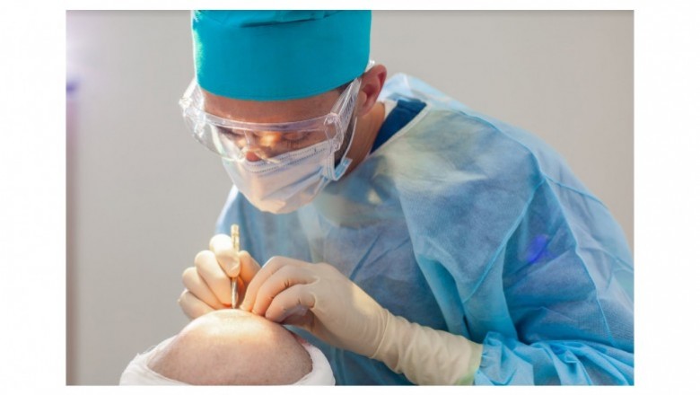 Best surgeon for hair transplant in india