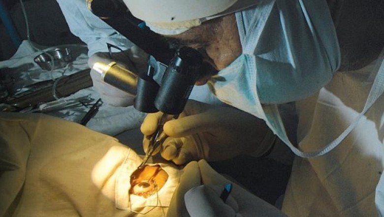 phacoemulsification courses in india | bimast