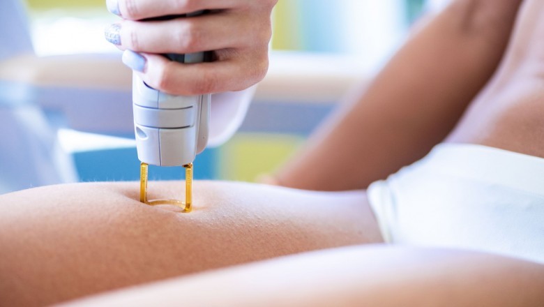 Easy laser hair removal technique by Veet