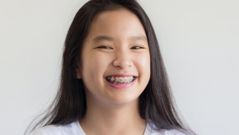 Orthodontics - Who Can Benefit From Orthodontic Treatment?