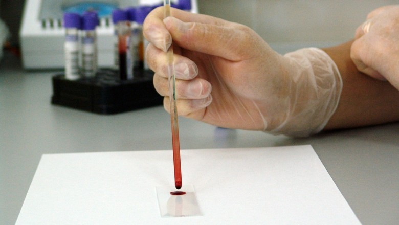 Designation And Eligibility Requirements Of Blood Banks Set To Change