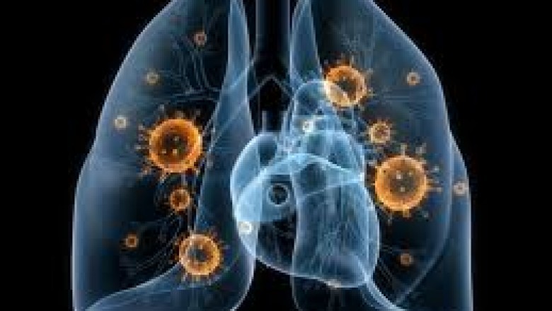 Lung Cancer Therapeutics Market Trends, Size, Forecast - 2018-2023