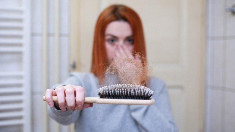 Best Hair Transplant Clinic in London