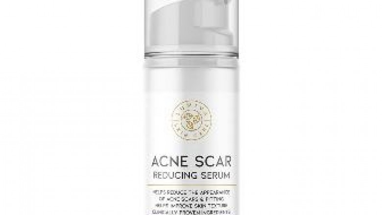 3 Facts You have to Know for Productive Acne Scar Treatment