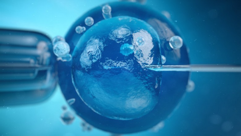 STEM CELL BANKING TEXAS