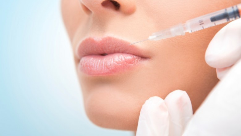 Best Lip Augmentation Treatment In London