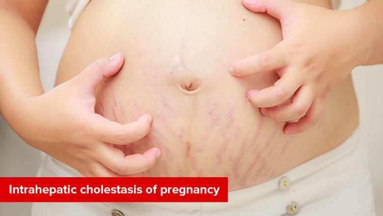 Intrahepatic cholestasis of pregnancy