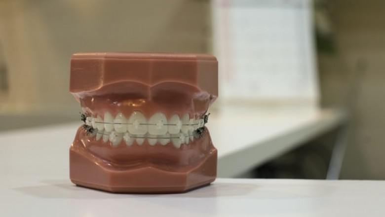 Aesthetic Dentistry Courses for Professionals