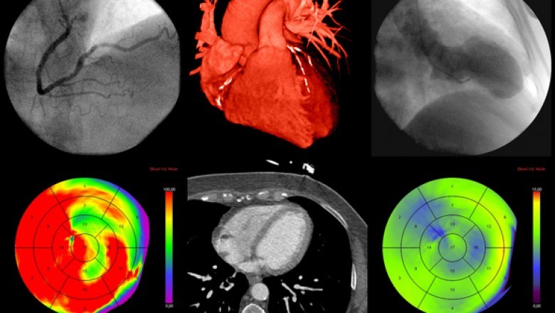 Breast Imaging Technologies Market by Competitive Analysis 2020 to 2030