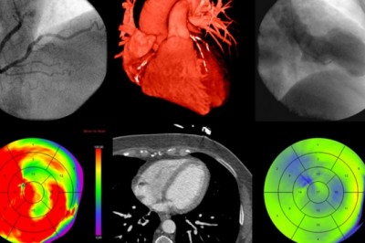 Breast Imaging Technologies Market by Competitive Analysis 2020 to 2030