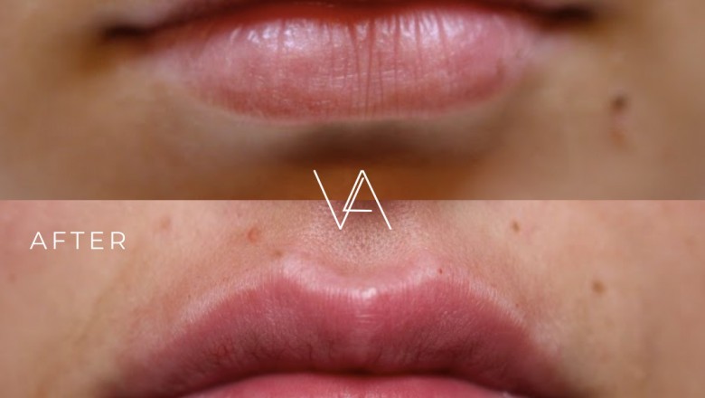 All the things You have to Know About Cosmetic Clinics