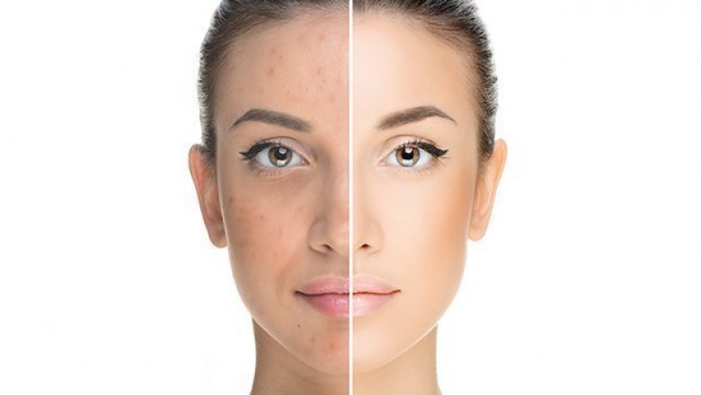 Best Advanced Skin care Solutions and Tips For Skincare 2020