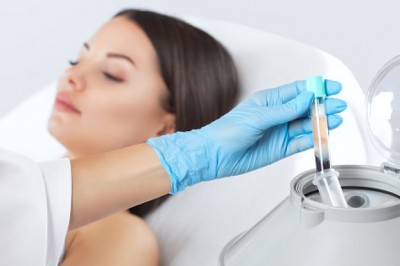 PRP Hair Loss Treatment London
