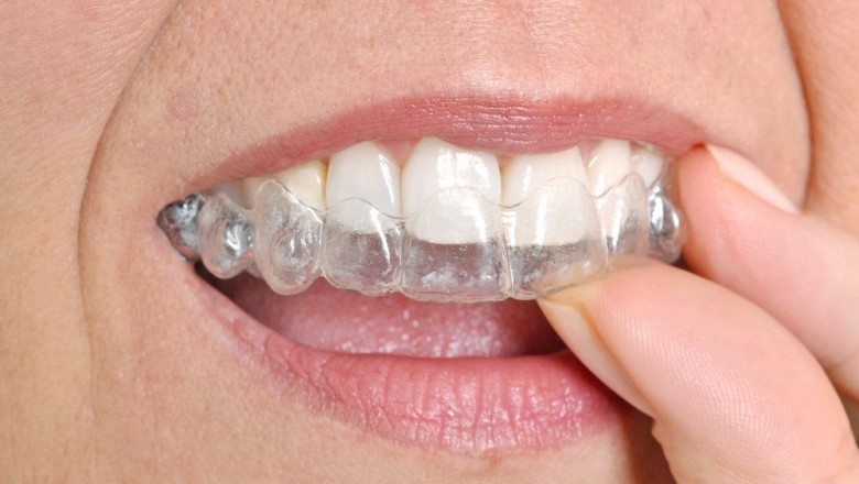 Are Braces bad for your teeth