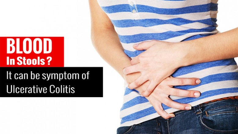 Blood in Stools? It can be Symptom of Ulcerative Colitis