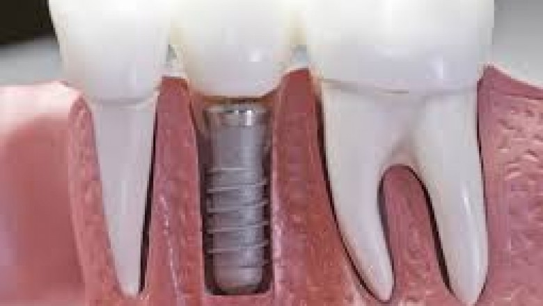 Dentistry Malden MA