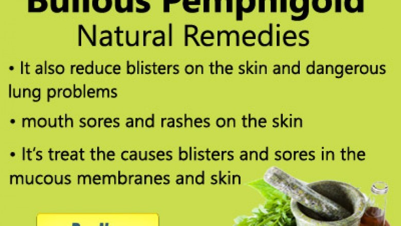 Herbal Treatment for Bullous Pemphigoid