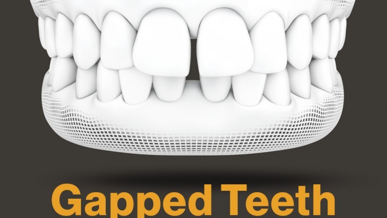 24 HOURS DENTAL CARE SERVICES IN ANCASTER