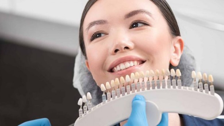 6 Things You Should Know About Dental Crowns