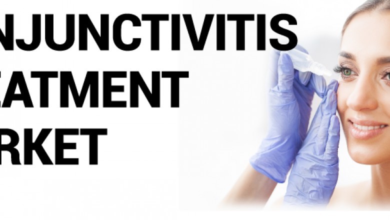 Conjunctivitis Treatment Market Growth, Global Survey, In-depth Analysis, Share, Company Profiles, Comprehensive Analysis Forecast by 2027