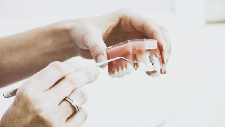 Why Should You Try the Orthodontic Courses UK?