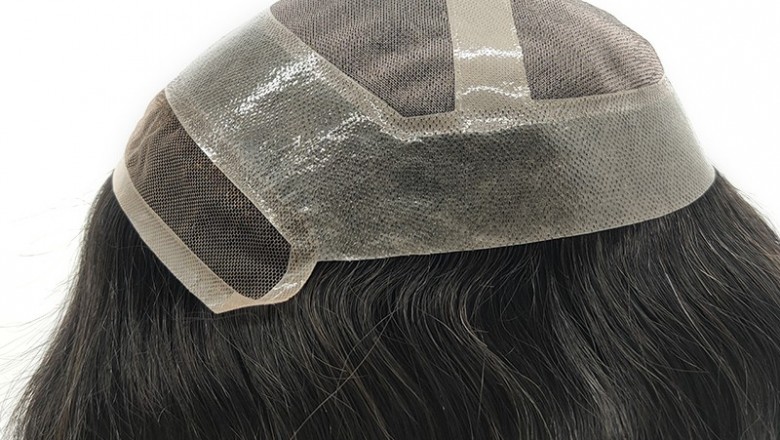 Can Arborvitae Leaf Help Hairless People Better Than Wigs?
