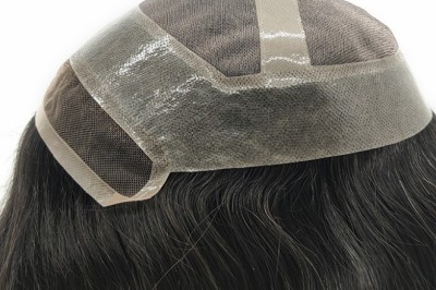 Can Arborvitae Leaf Help Hairless People Better Than Wigs?