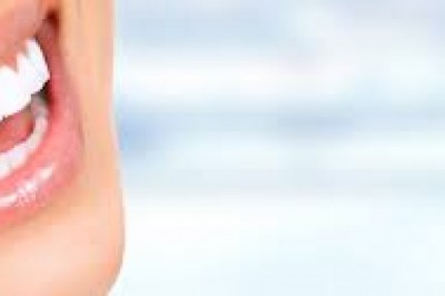 7 Things Parents Need to Know About Invisalign Teen